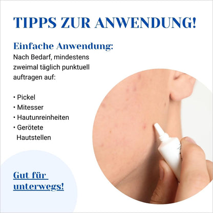 Pimple Acute Gel (15ml): Acne facial care against impurities with clarifying salicylic acid