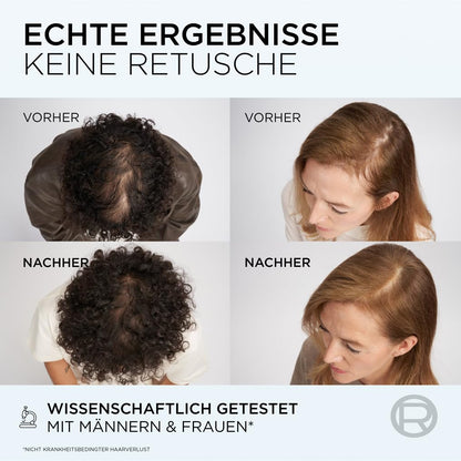 L'Oréal Paris Fiber Booster Anti-Haarverlust-Kopfhaut-Serum: Gegen Haarausfall (3x 102ml)